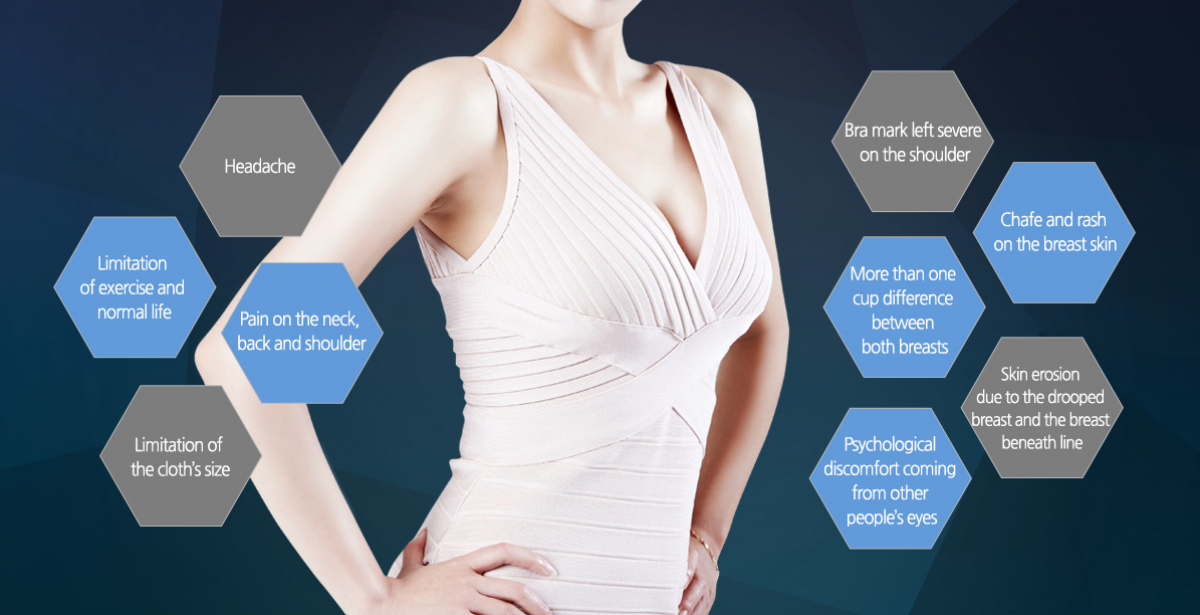 Reduction Mammoplasty GRACEONYOUNG PLASTIC SURGERY